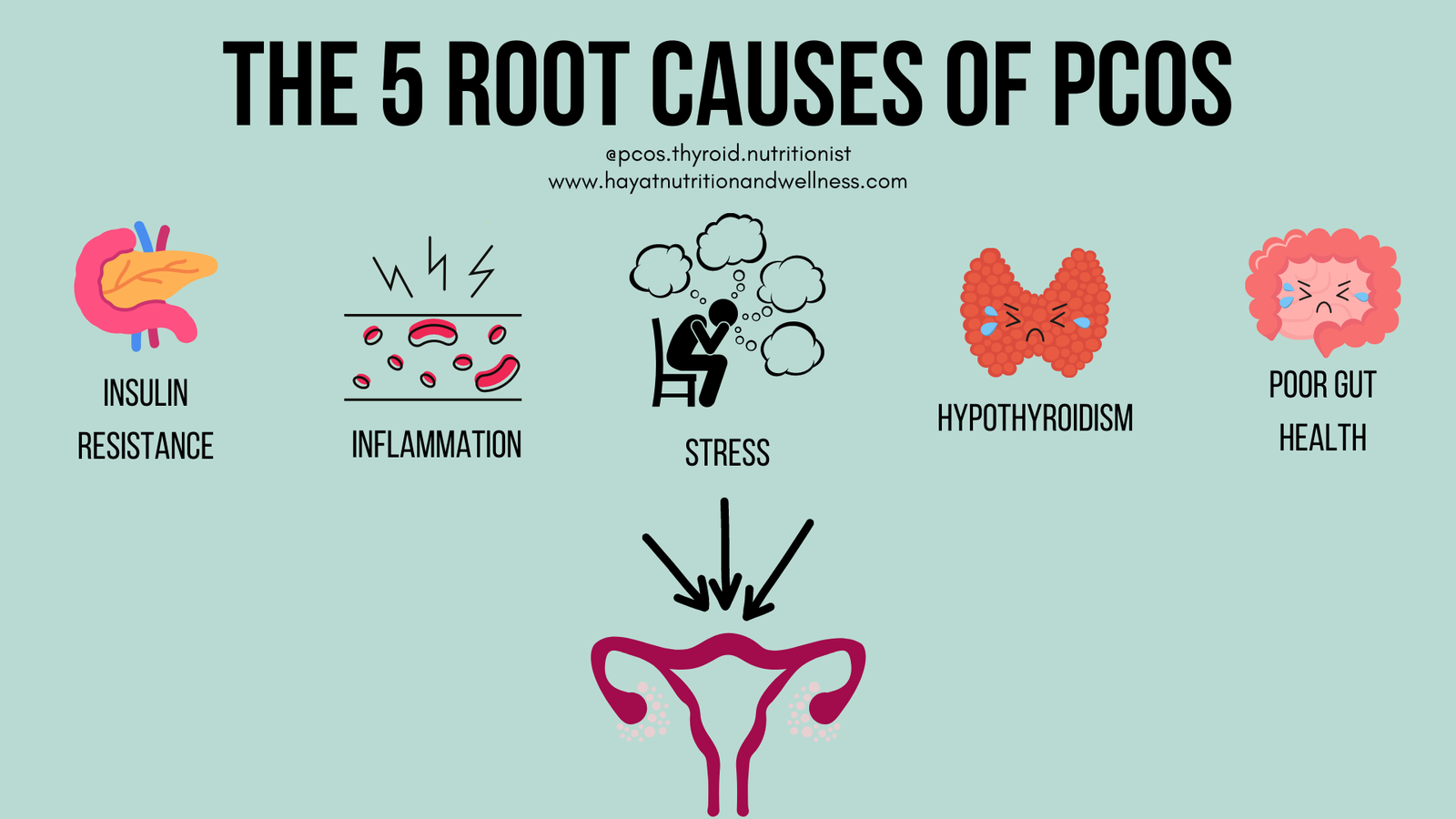 A rectangular block with a title "The 5 Root Causes of PCOS" 

Below the title, there are two blocks of texts, which read "@pcos.thyroid.nutritionist" and "www.hayatnutritionandwellness.com."

Below that are 5 images. Starting from the left, the first image is of a pancreas with the text "insulin resistance" below it.

The next image is a graphic showing the blood stream and 3 lightning drawings above that, to indicate inflammation. The text below this image says "inflammation."

The next image is a graphic of a person sitting in a chair with their hands to their head. 4 thought bubbles surround the person, indicating they are stressed. Below this image is the word "Stress."

The next image is a graphic of the thyroid gland with a sad face. The text below this image reads "hypothyroidism."

The last image all the way on the right is a graphic of the digestive system with a sad face. The text below this reads "poor gut health."

Below this row of images are 3 arrows pointing below.

Underneath the arrows is a graphic of the female anatomy, showing the ovaries. 